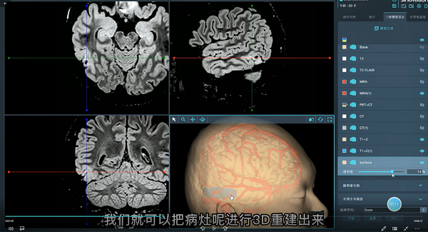 图片 1.png